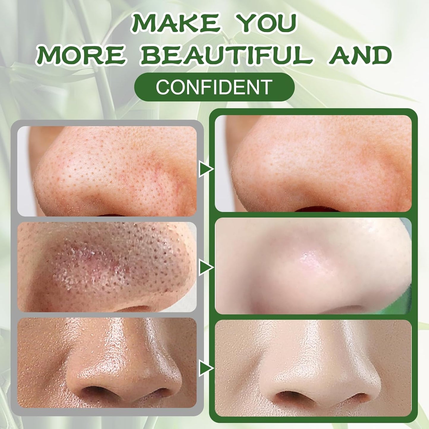 Blackhead Removal Strips | Dreamscape