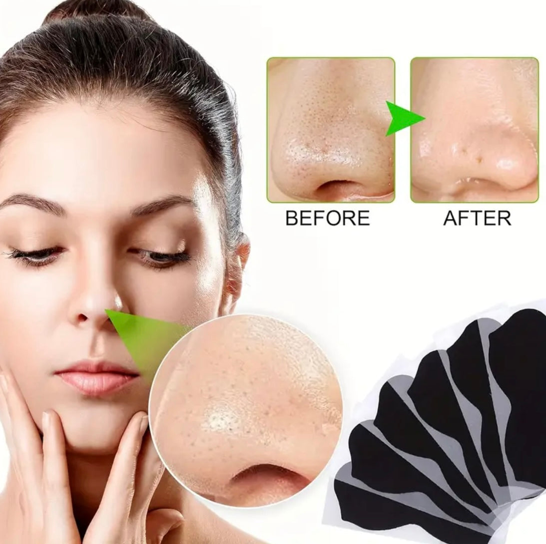 Strong black head nose patches | Dreamscape