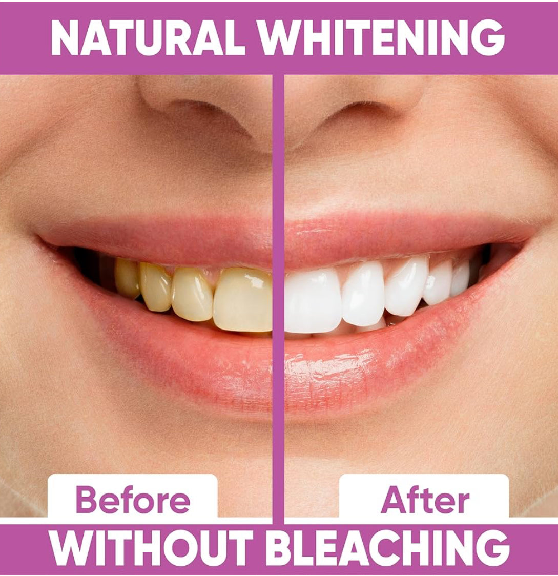 Inopro Whitening Strips | Dreamscape